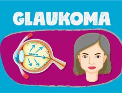 Mitos dan Fakta Glaukoma: Penyebab Kebutaan Tanpa Gejala, Waspada Mulai Usia 40 Tahun